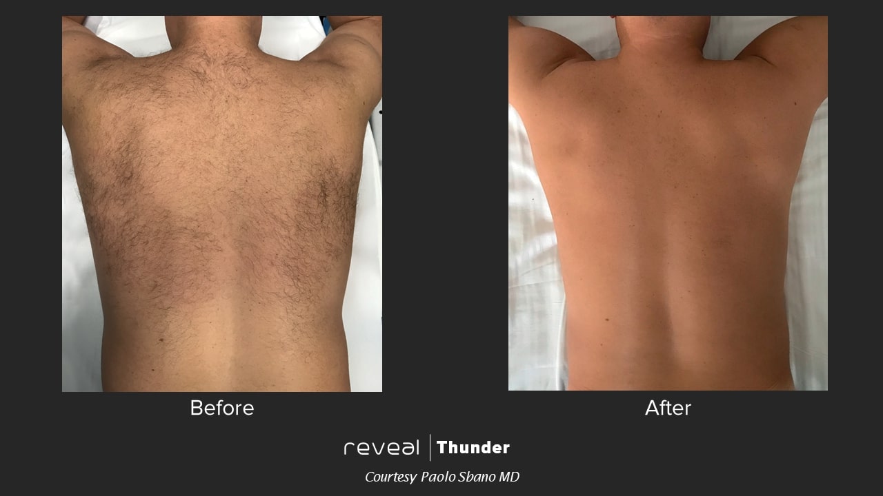 thunder before and after 1